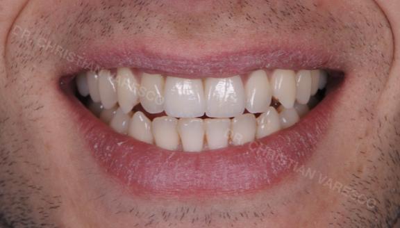 Casi clinici 15 Casi clinici svg+xml;charset=utf