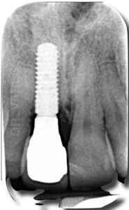 Casi clinici 16 Casi clinici svg+xml;charset=utf